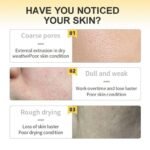 Acne Care Glow Sheet Mask – Instant Brightening for Clear, Radiant Skin - Image 4