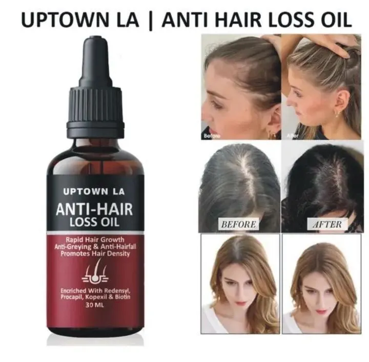 1779515157424 Anti Hair Fall Hair Serum – Nourishing Hair Growth Serum for Stronger, Healthier Looking Hair - Image 1
