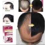 Premium Onion Hair Oil for Hair Growth, Hair Fall Control & Stronger Hair - Image 2